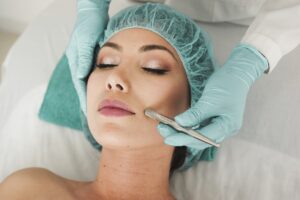Revolution der Hautverjüngung: Dermapen-Behandlung